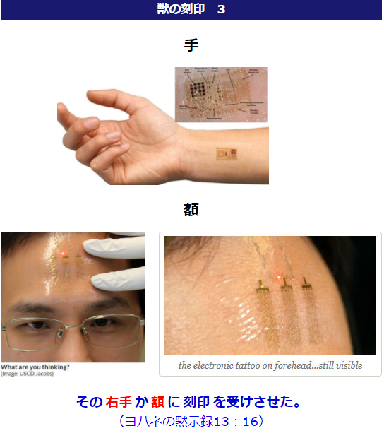 重い副作用でワクチンの臨床試験一時停止