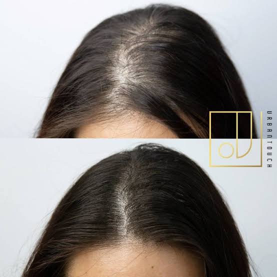 効果のあるヘアケア