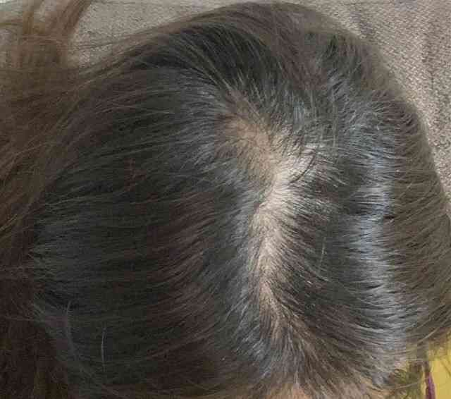 効果のあるヘアケア
