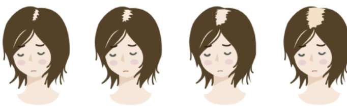 効果のあるヘアケア