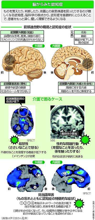 73歳女「普通のエッチ、ここのホテル行こうよ」 売春に誘った相手は警戒中の私服警察官…女を現行犯逮捕