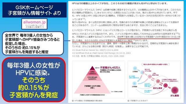 HPVワクチンで「子宮頸がんリスク5割低下」 スウェーデンの研究チーム
