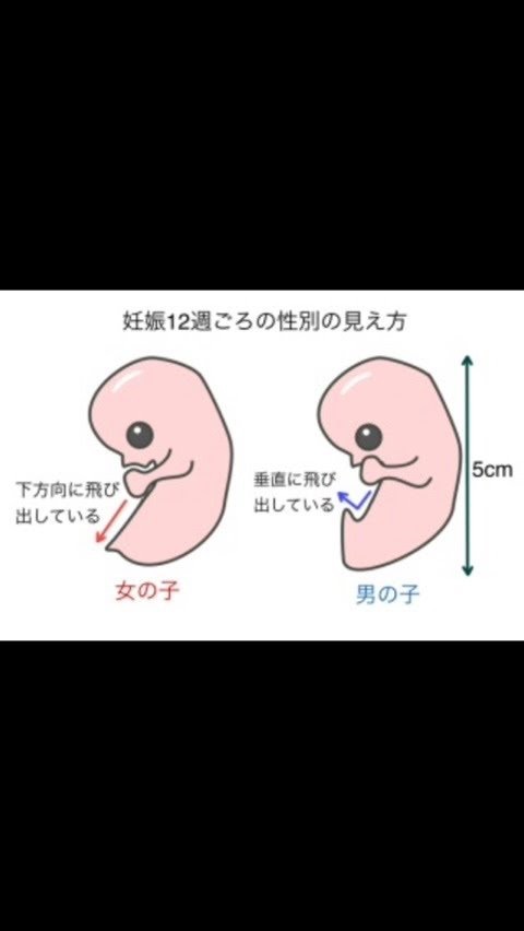 妊娠中期の方、語りませんか？part1