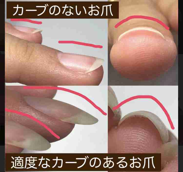 爪をケアするようになって1年、ビフォーアフターが凄い「爪の形変えられるの初めて知った」