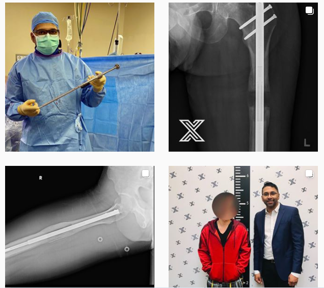 800万円で背を伸ばす手術。「15センチ高くなる」に予約殺到