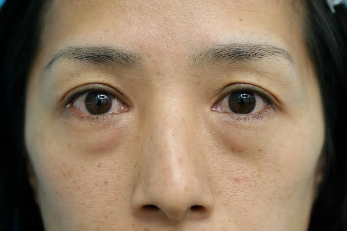 アラフォーのスキンケア