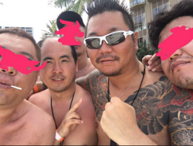 トレエン斎藤司、元気な姿で漫才披露「もう動けます」 ロケの重症から1ヶ月半