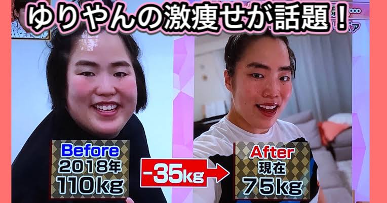 36キロ減量のゆりやんレトリィバァがダイエット後の変化を告白「めちゃくちゃモテる」