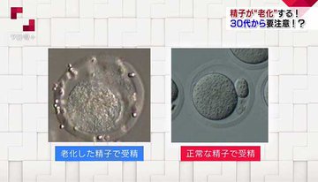 不妊治療「22年度保険適用」…政府の工程表が判明