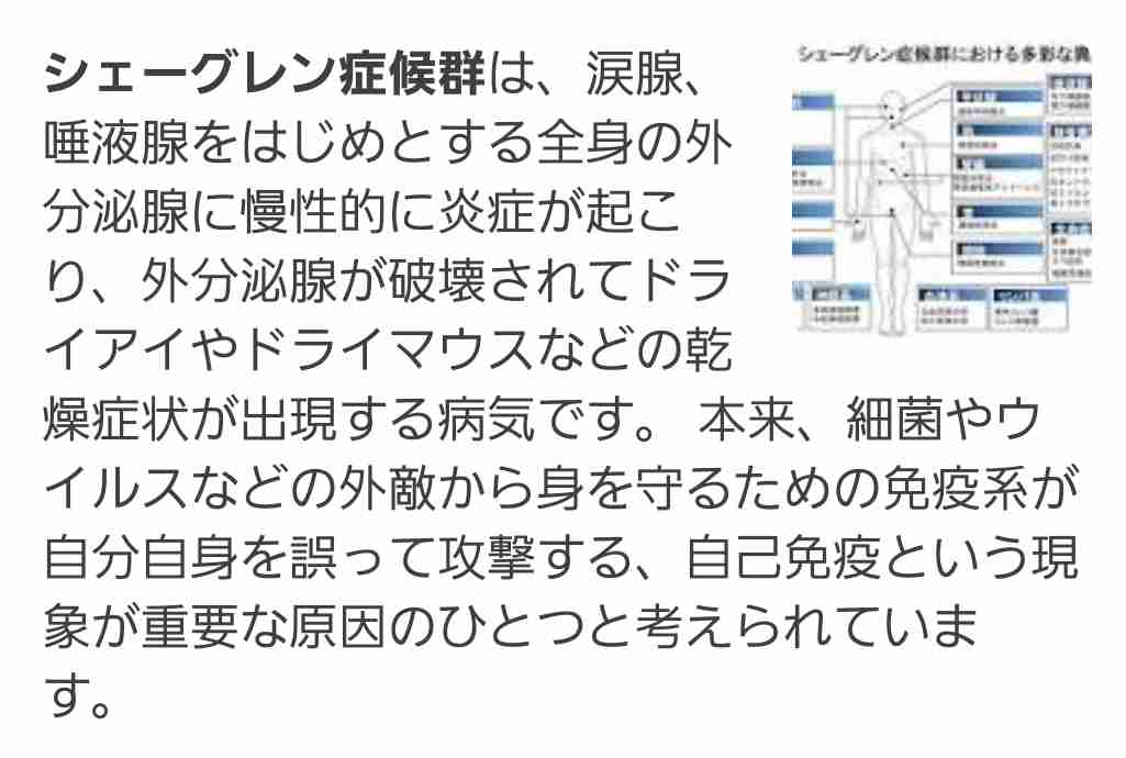 シェーグレン症候群の人