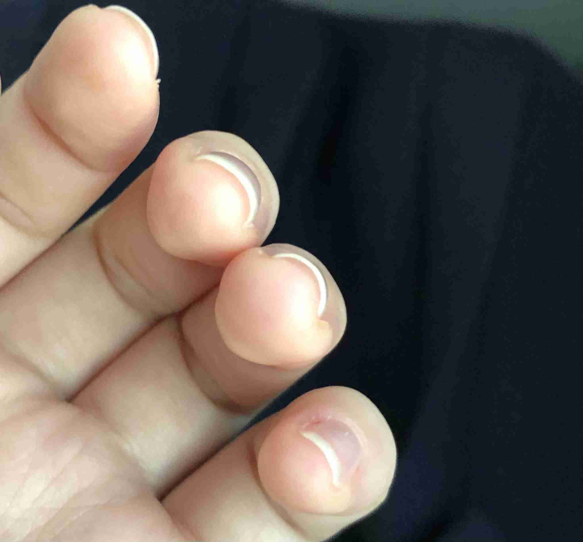 励まし合って自爪を伸ばすトピ
