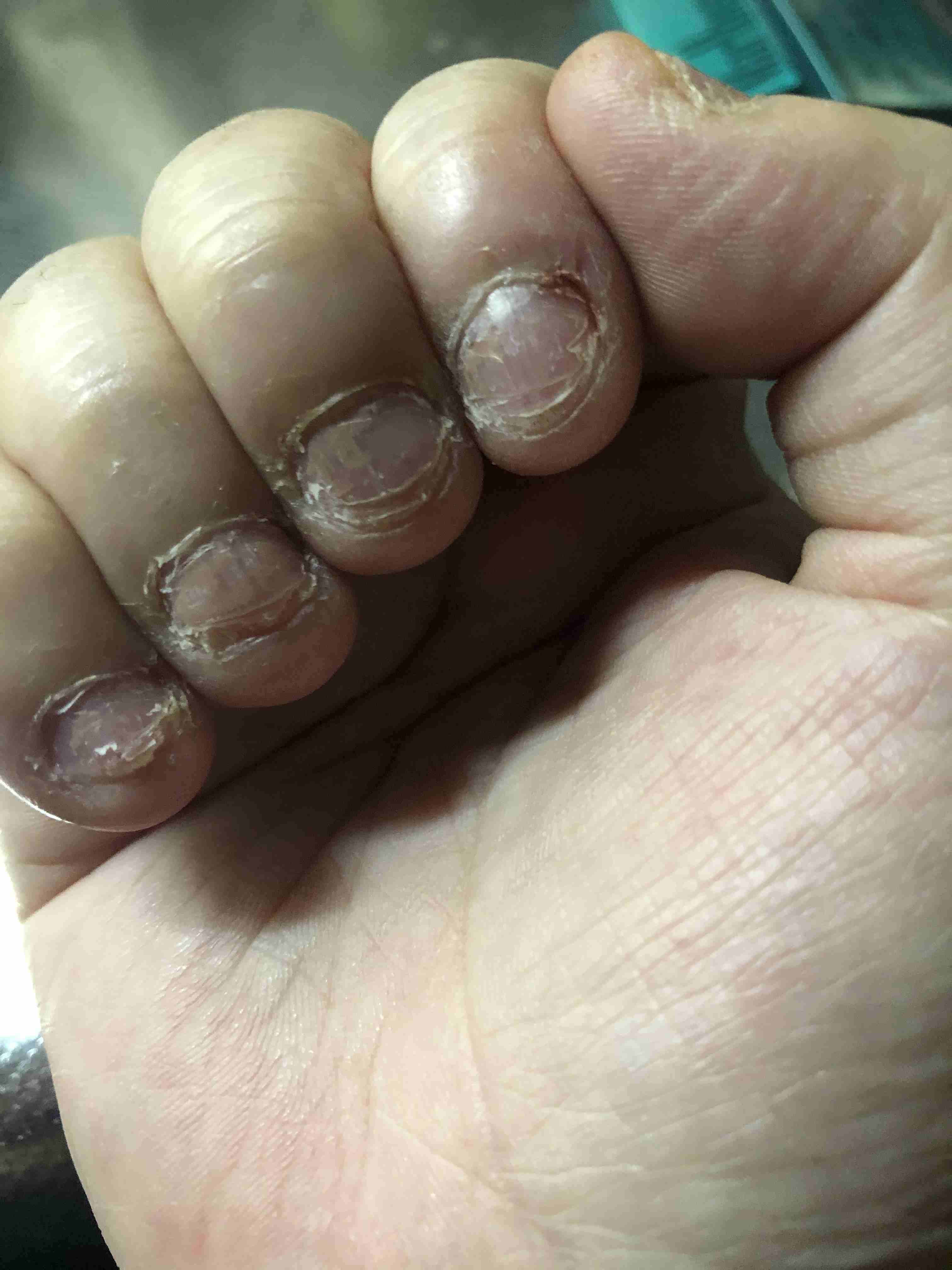 励まし合って自爪を伸ばすトピ