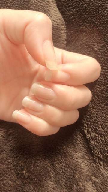 励まし合って自爪を伸ばすトピ