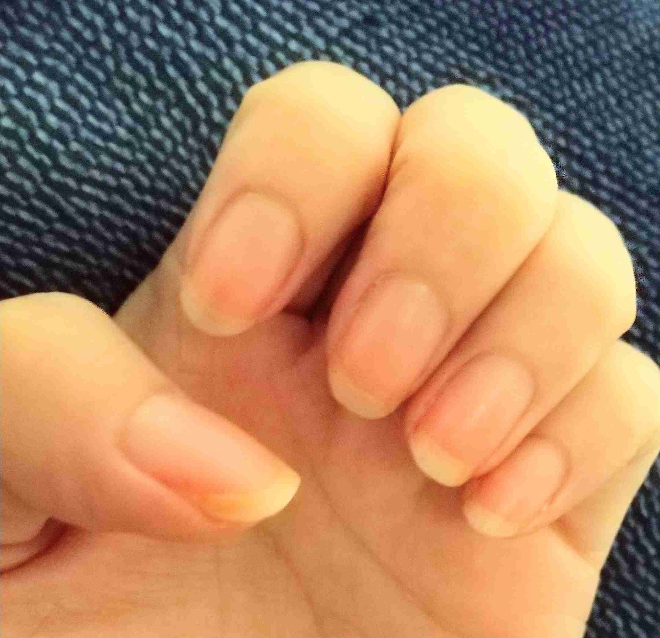 励まし合って自爪を伸ばすトピ