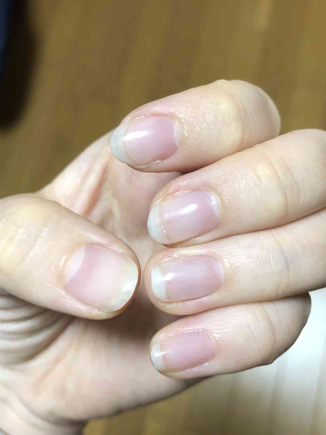 励まし合って自爪を伸ばすトピ