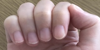 励まし合って自爪を伸ばすトピ