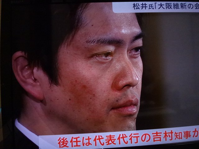 コロナワクチン迅速接種へ法改正 接種費用、政府が負担 閣議決定