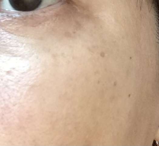 美容皮膚科通ってる方