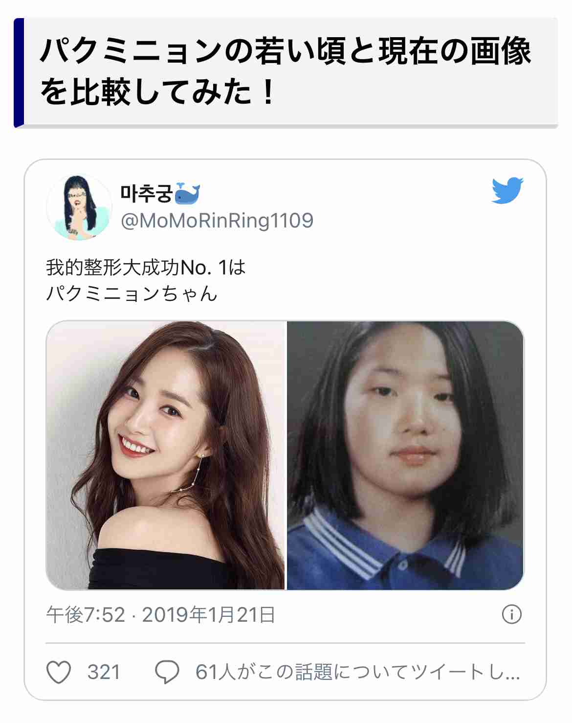 整形で失敗する人と成功する人の違い