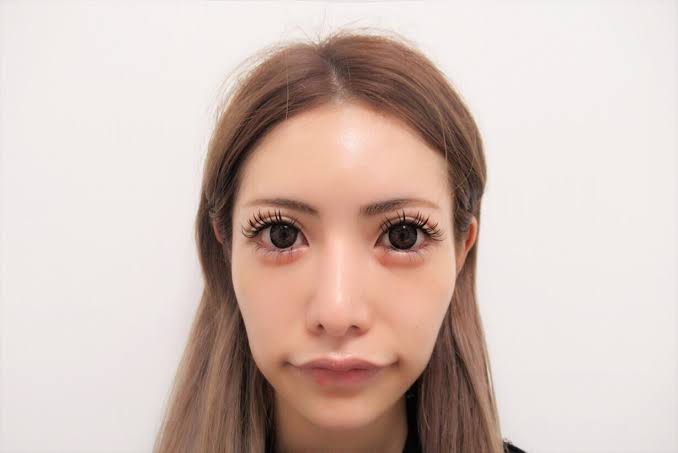 整形で失敗する人と成功する人の違い