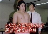 整形で失敗する人と成功する人の違い