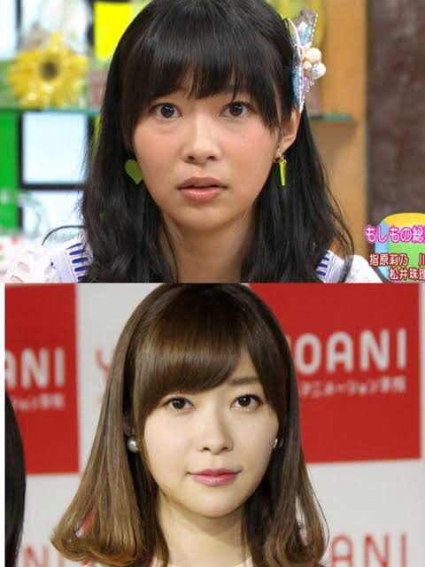 指原莉乃、顔や唇の腫れ告白「恐らくクインケ浮腫」フォロワーから「わたしも…」「早く良くなって」