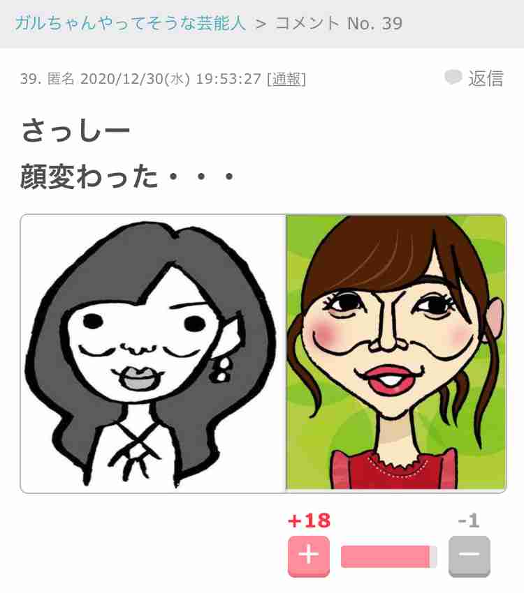 指原莉乃、顔や唇の腫れ告白「恐らくクインケ浮腫」フォロワーから「わたしも…」「早く良くなって」
