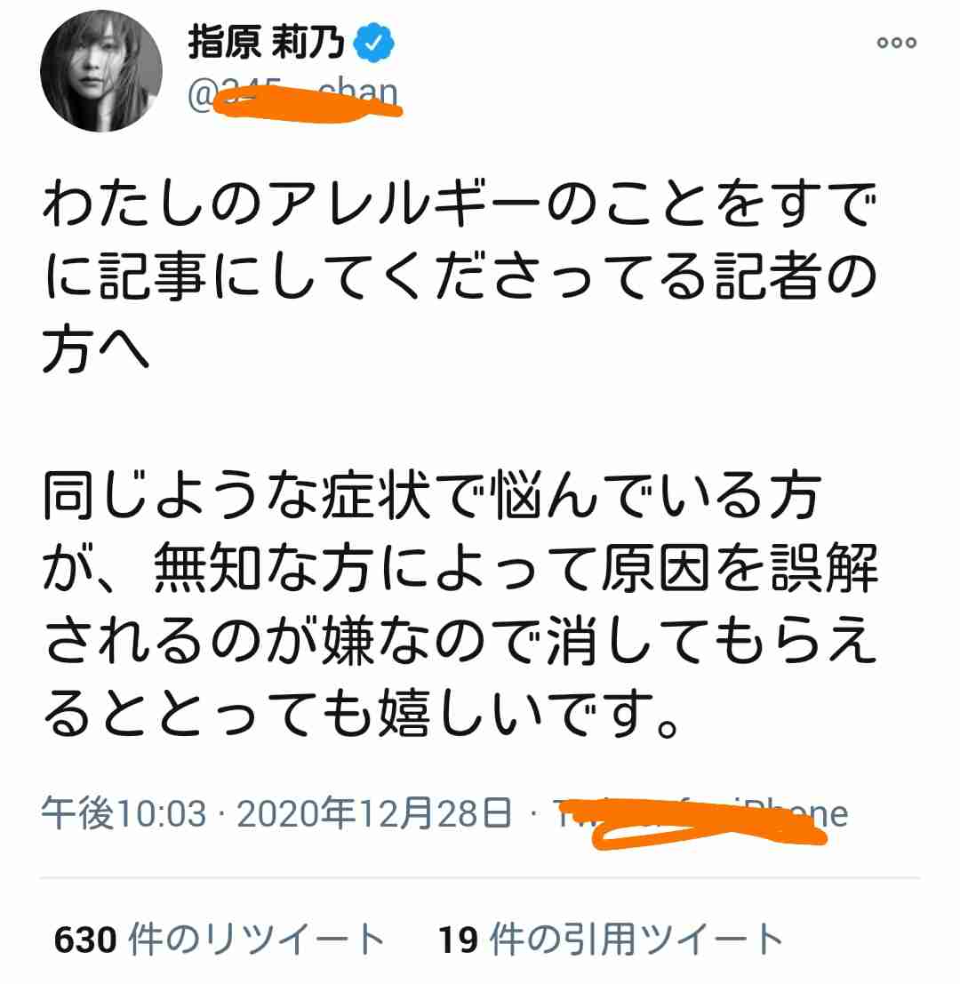 指原莉乃、顔や唇の腫れ告白「恐らくクインケ浮腫」フォロワーから「わたしも…」「早く良くなって」