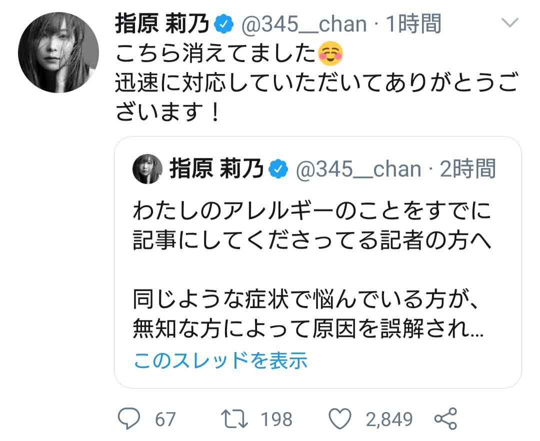 指原莉乃、顔や唇の腫れ告白「恐らくクインケ浮腫」フォロワーから「わたしも…」「早く良くなって」