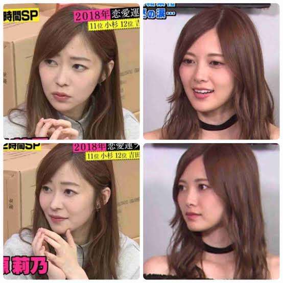 指原莉乃、顔や唇の腫れ告白「恐らくクインケ浮腫」フォロワーから「わたしも…」「早く良くなって」