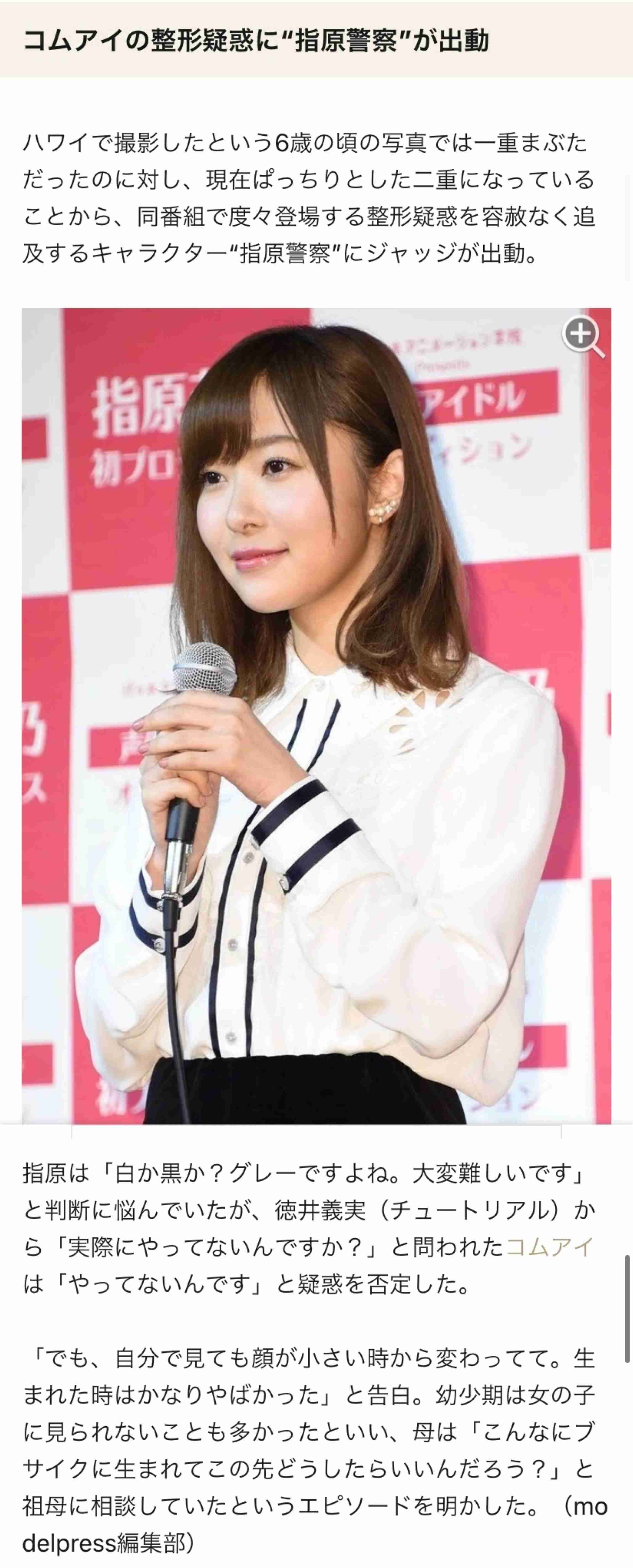 指原莉乃、顔や唇の腫れ告白「恐らくクインケ浮腫」フォロワーから「わたしも…」「早く良くなって」