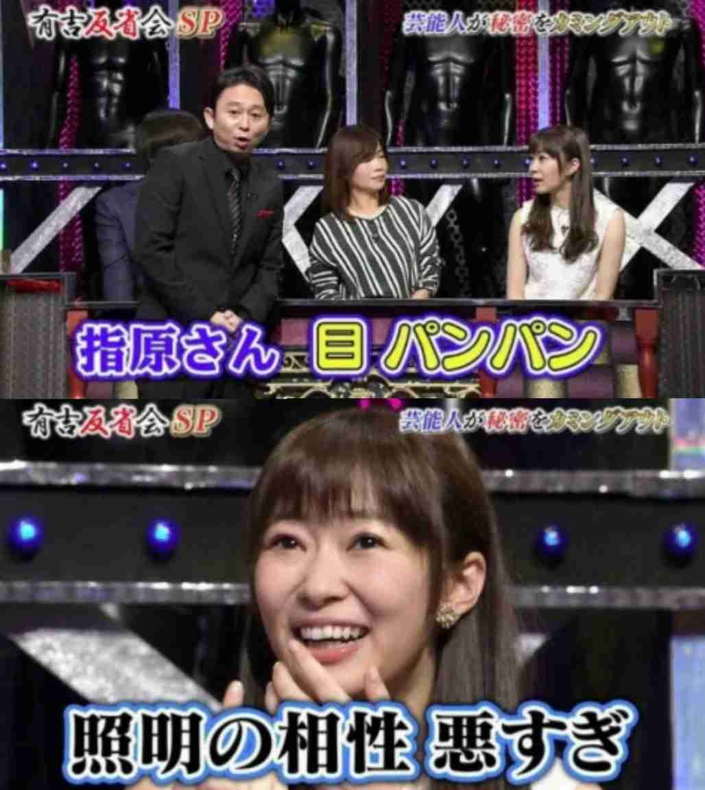 指原莉乃、顔や唇の腫れ告白「恐らくクインケ浮腫」フォロワーから「わたしも…」「早く良くなって」