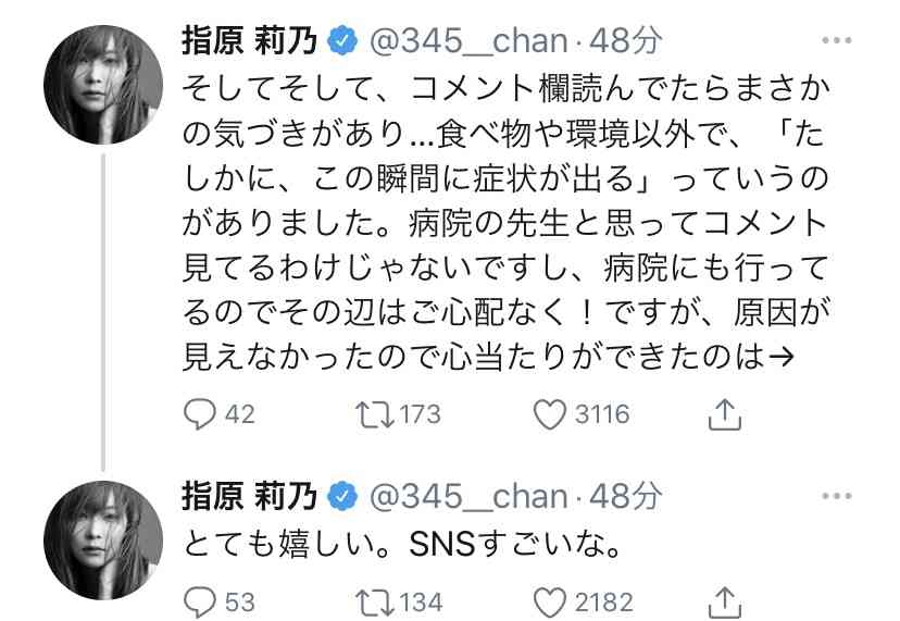 指原莉乃、顔や唇の腫れ告白「恐らくクインケ浮腫」フォロワーから「わたしも…」「早く良くなって」