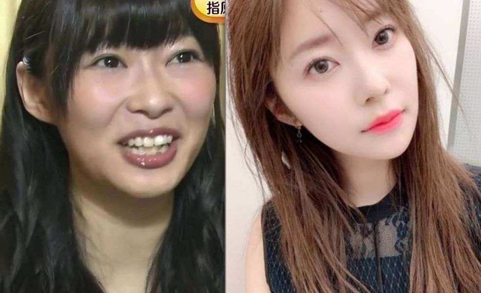 指原莉乃、顔や唇の腫れ告白「恐らくクインケ浮腫」フォロワーから「わたしも…」「早く良くなって」