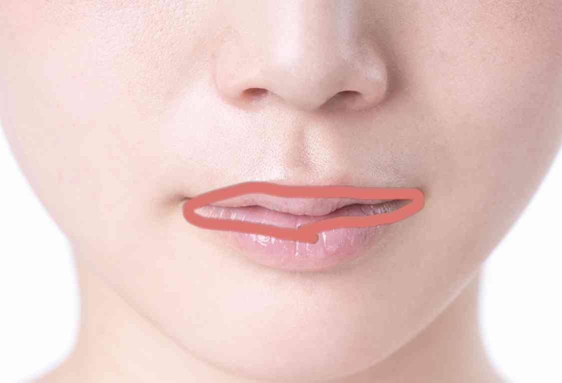 口元の悩み　【総合】