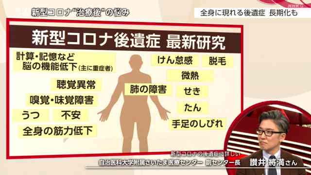 新型コロナ感染の30代女性 後遺症の脱毛で頭頂部はまばらに…「外に出るのもつらい」