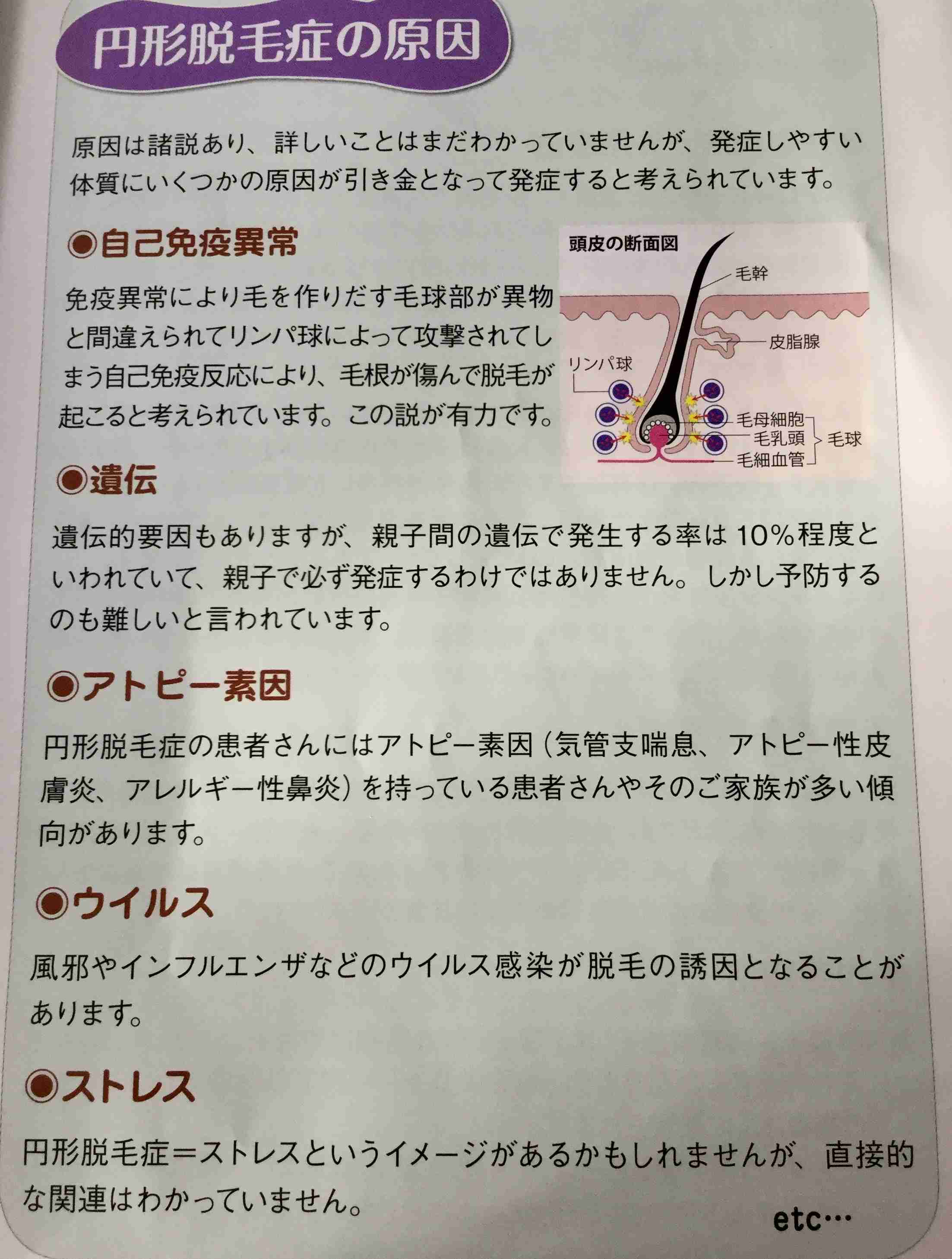 新型コロナ感染の30代女性 後遺症の脱毛で頭頂部はまばらに…「外に出るのもつらい」