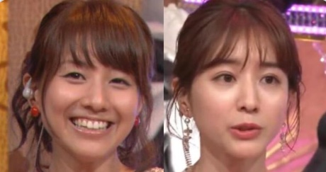 整形してないのに整形疑われる人ー ガールズちゃんねる Girls Channel