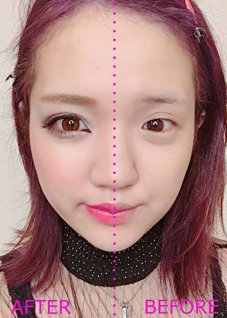 整形してないのに整形疑われる人ー！