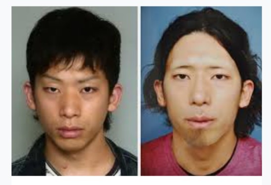 【教えて】ホクロ取ったことある方