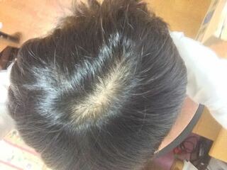 【悩み】毛量少なめの人のヘアアレンジ