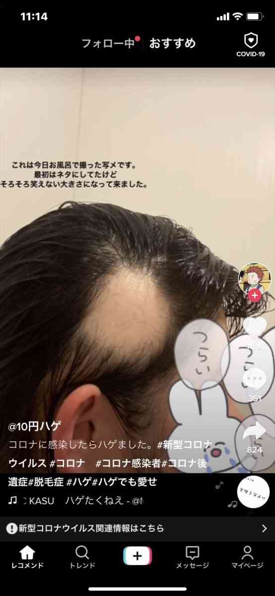 朝日奈央 友人の新型コロナ後遺症を語る「改めて怖さを知った」