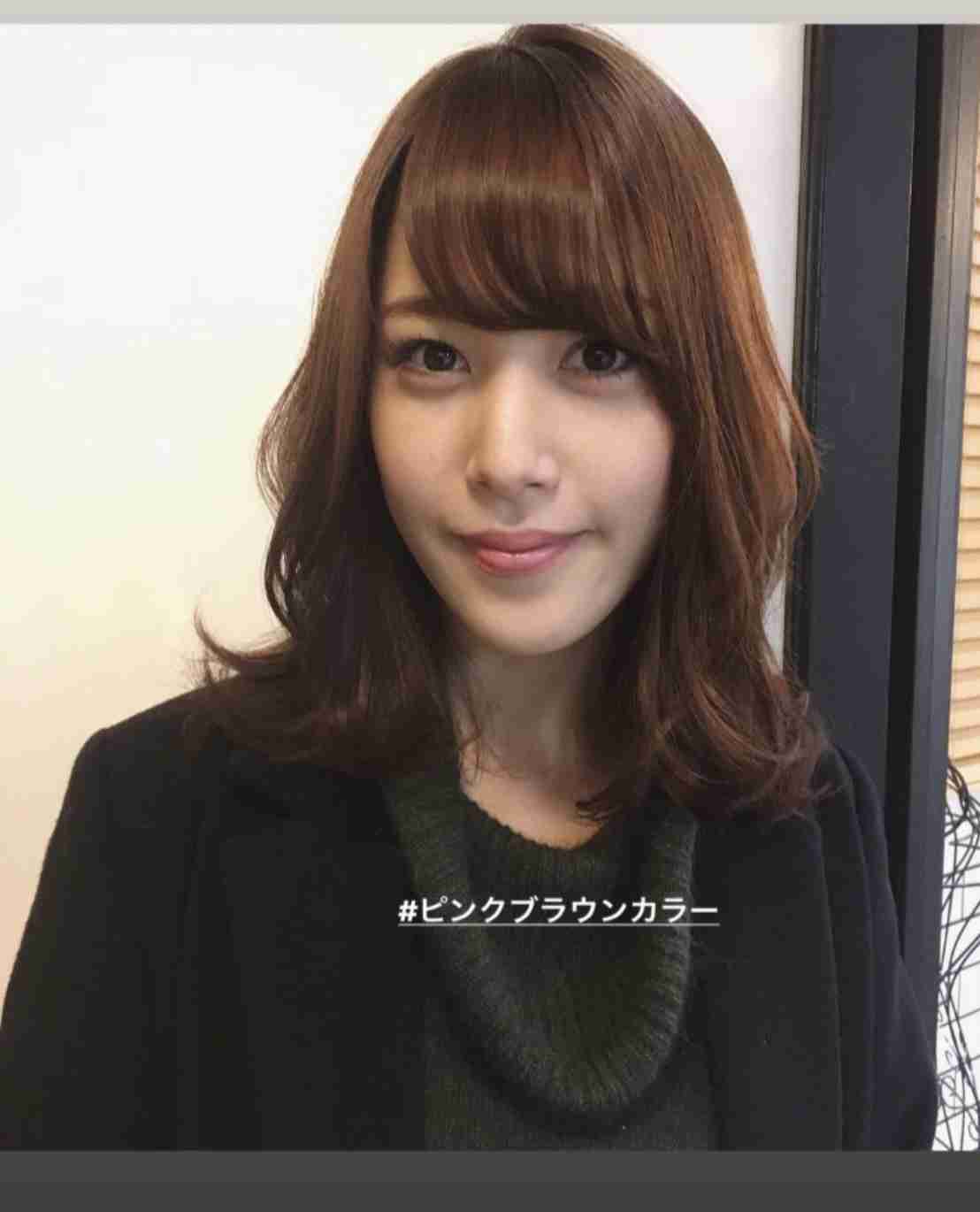 鷲見玲奈アナ、ひどい肌荒れに死よぎった…克服し美しい肩を見せ「綺麗すぎる」の声