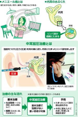 突発性難聴または低音性難聴になったことがある人