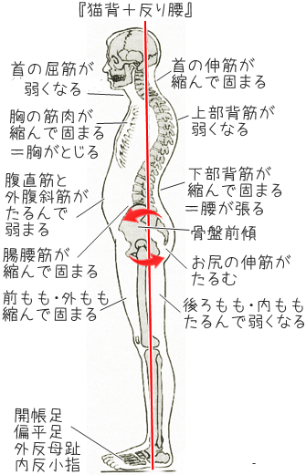 反り腰のひと〜〜