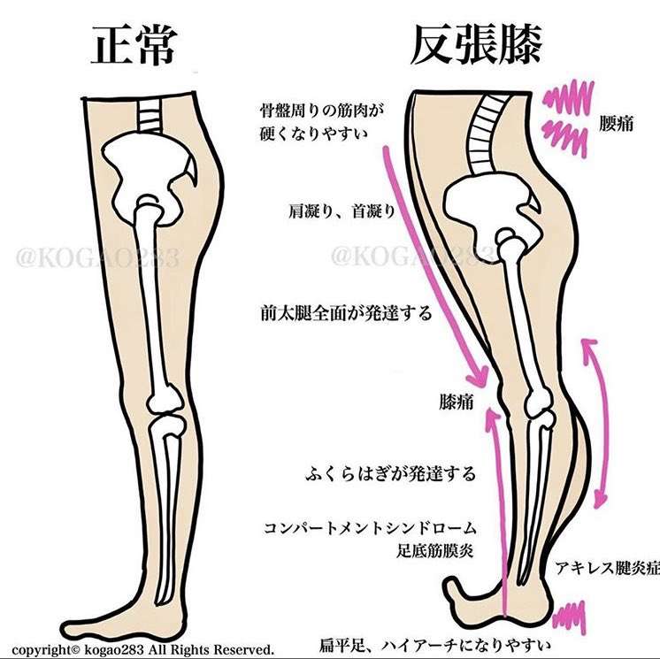 反り腰のひと〜〜
