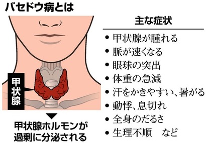 バセドウ病と戦っている方