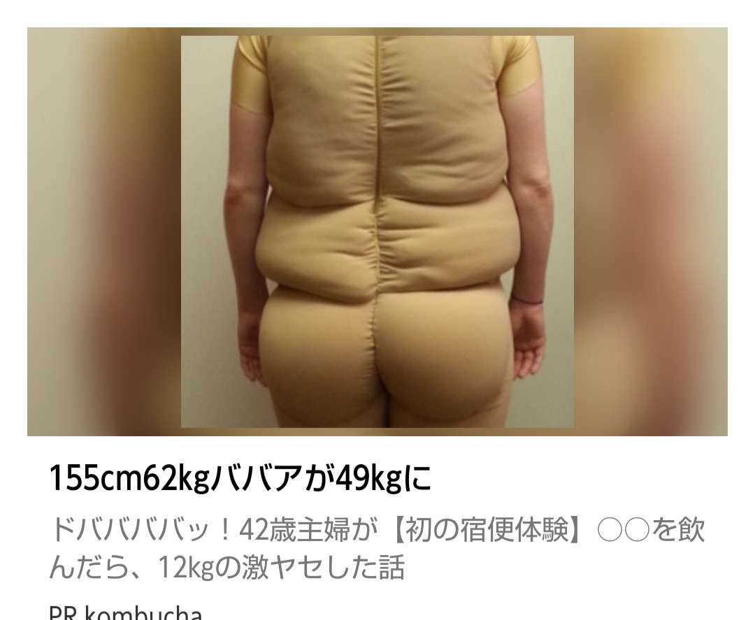 プチ驚いた画像を貼ってみるトピpart2