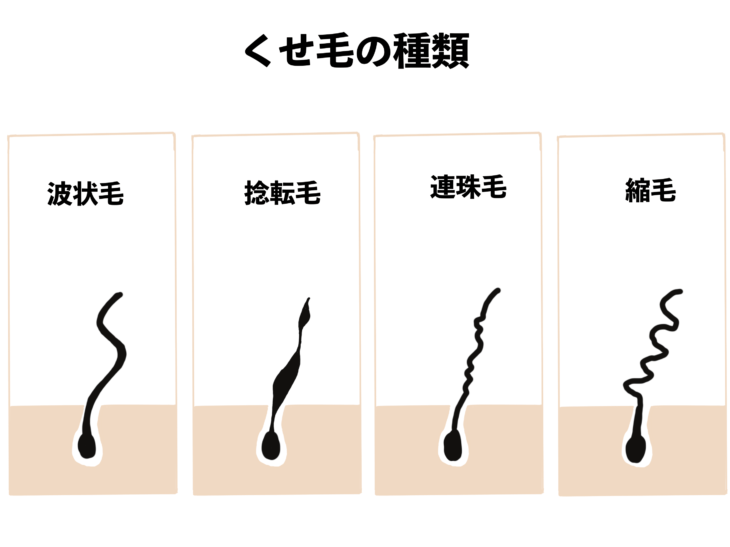 抜毛症の方お集まり下さいませ。