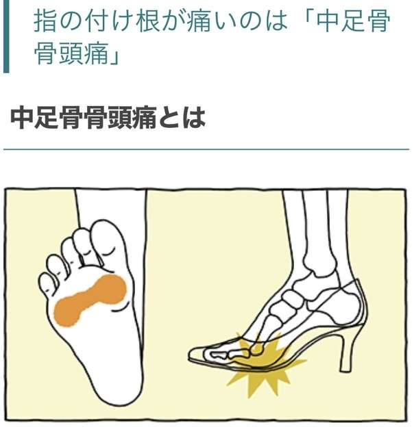 ヒールブーツが痛い人! 前滑り対策どうしてます?